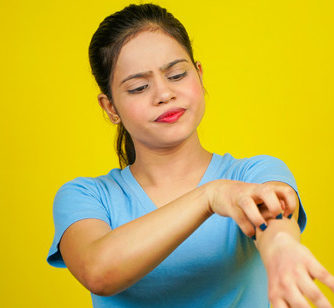 Which skin creams are most effective for eczema?